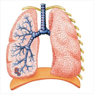 Otc Bronchial Medications - The Relationship Between Bronchial Asthma Bronchitis And Acid Reflux