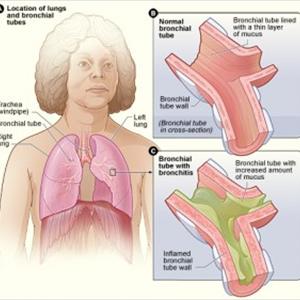 Mucus In Chest - What You Must Know About The Advantages Of Slimmer Spa